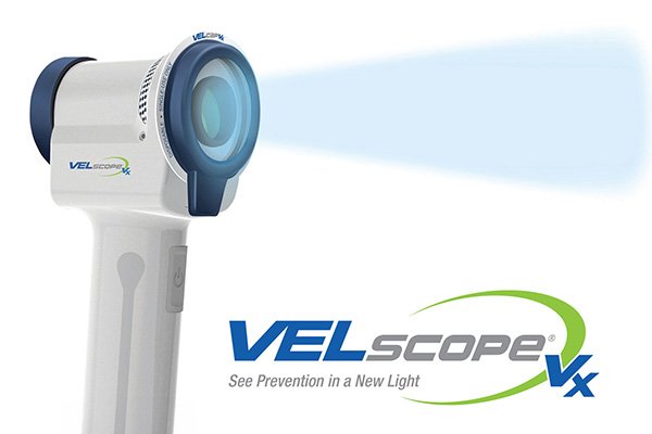 VELScope